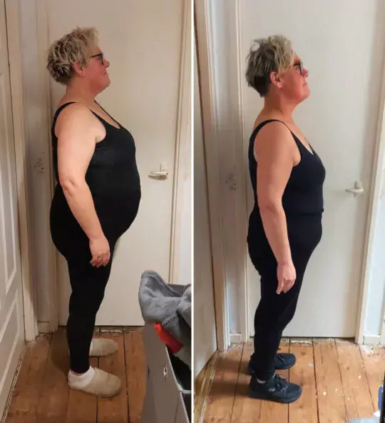 Oviva Patientin Heide vorher